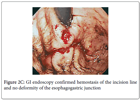 gastrointestinal-digestive-system-GI-endoscopy