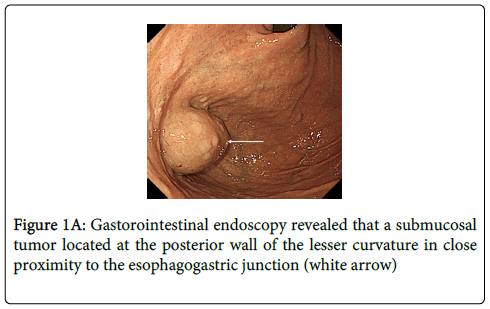 gastrointestinal-digestive-system-Gastorointestinal-endoscopy