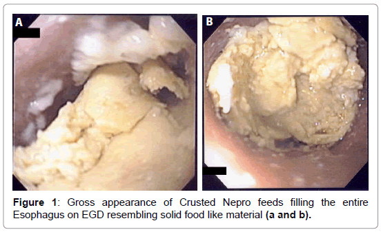 gastrointestinal-digestive-system-Gross-appearance