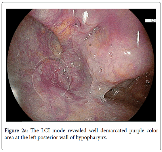 gastrointestinal-digestive-system-LCI-mode
