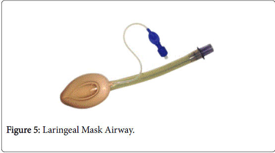 gastrointestinal-digestive-system-Laringeal-Mask