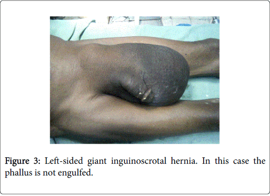 gastrointestinal-digestive-system-Left-sided