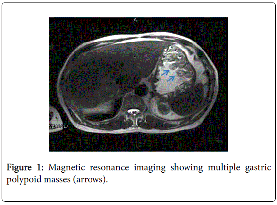 gastrointestinal-digestive-system-Magnetic-resonance