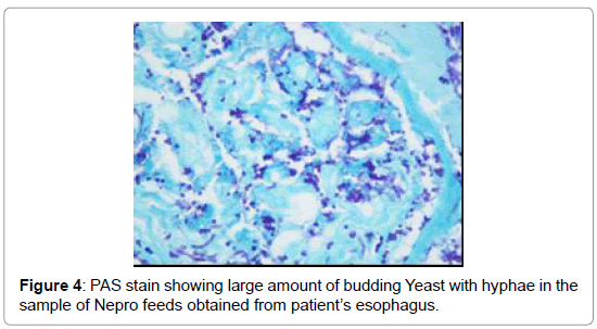 gastrointestinal-digestive-system-Nepro-feeds