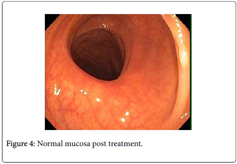 gastrointestinal-digestive-system-Normal-mucosa