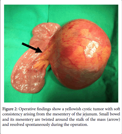 gastrointestinal-digestive-system-Operative-findings
