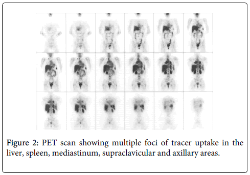 gastrointestinal-digestive-system-PET-scan