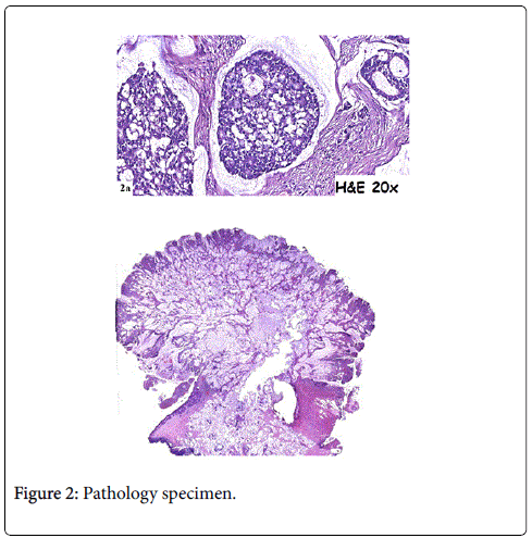 gastrointestinal-digestive-system-Pathology-specimen