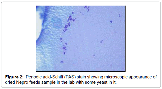 gastrointestinal-digestive-system-Periodic-acid-Schiff