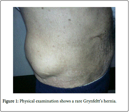gastrointestinal-digestive-system-Physical-examination
