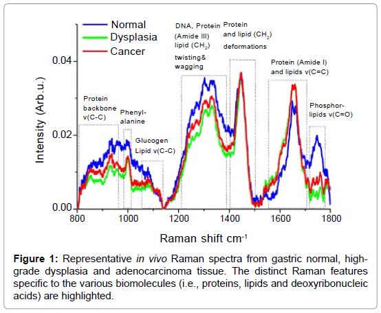gastrointestinal-digestive-system-Raman-spectra