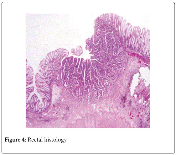gastrointestinal-digestive-system-Rectal-histology