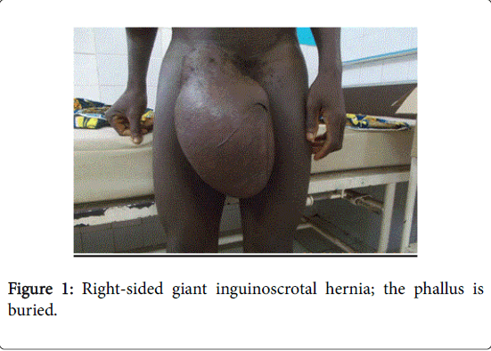 gastrointestinal-digestive-system-Right-sided