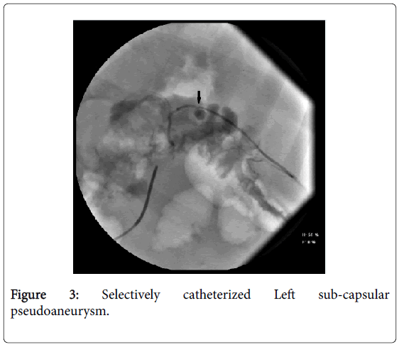 gastrointestinal-digestive-system-Selectively-catheterized