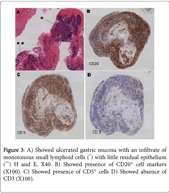 gastrointestinal-digestive-system-Showed-absence