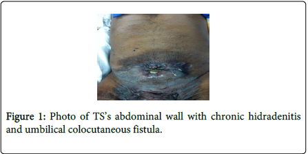 gastrointestinal-digestive-system-Small-bowel