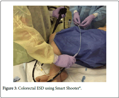 gastrointestinal-digestive-system-Smart-Shooter