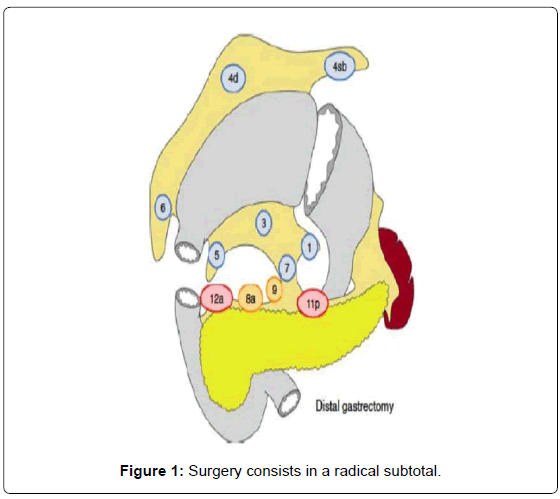 gastrointestinal-digestive-system-Surgery-consists
