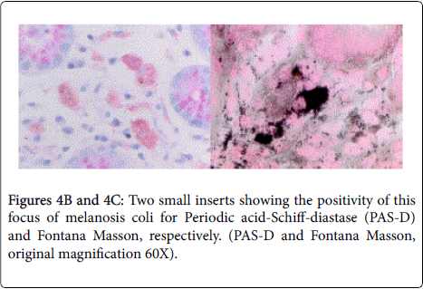 gastrointestinal-digestive-system-acid-Schiff-diastase