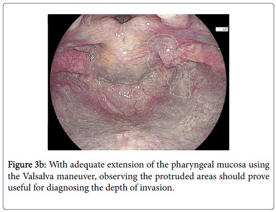 gastrointestinal-digestive-system-adequate-extension