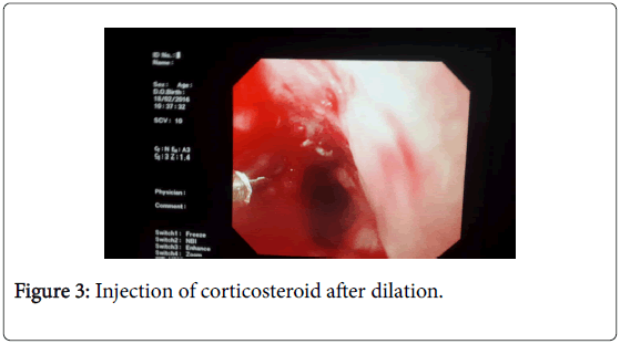 gastrointestinal-digestive-system-after-dilation