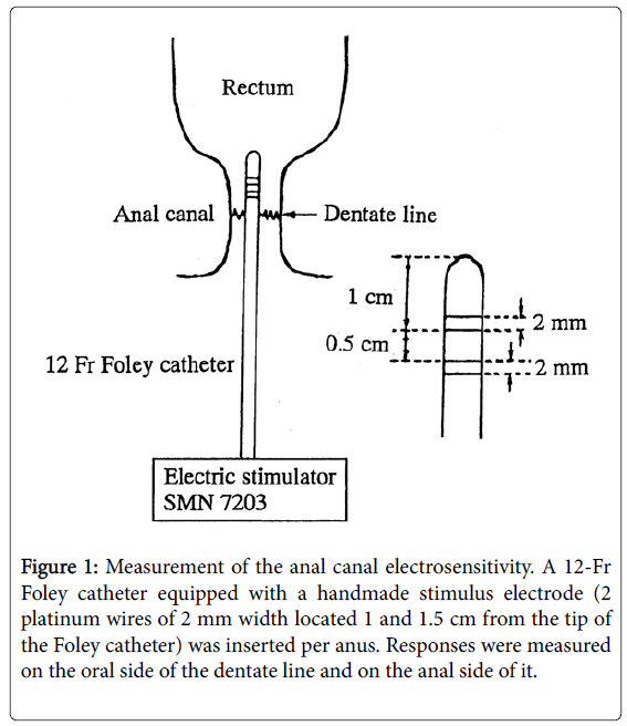 gastrointestinal-digestive-system-anal-canal-electrosensitivity