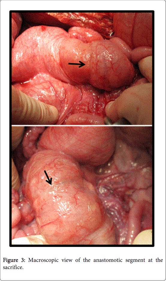 gastrointestinal-digestive-system-anastomotic-segment