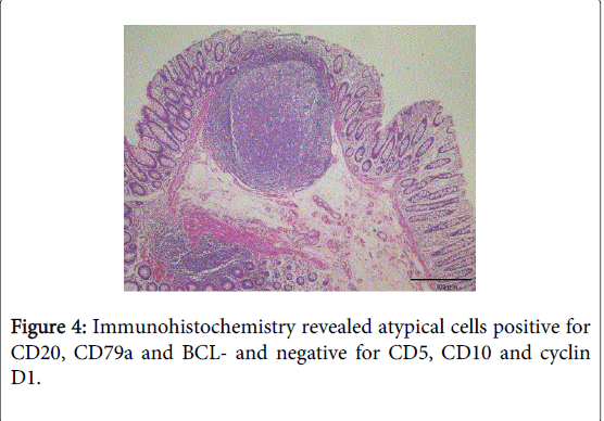 gastrointestinal-digestive-system-atypical-cells