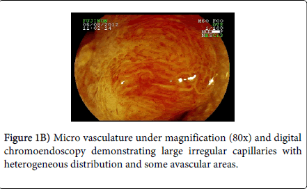 gastrointestinal-digestive-system-avascular-areas