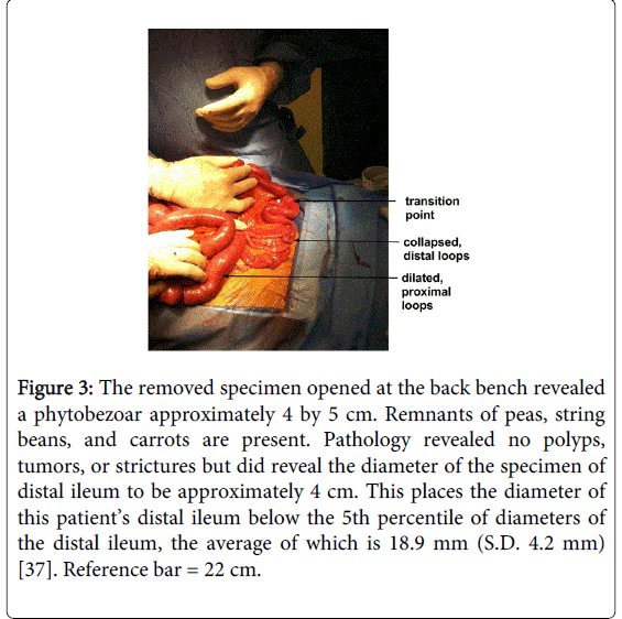 gastrointestinal-digestive-system-back-bench