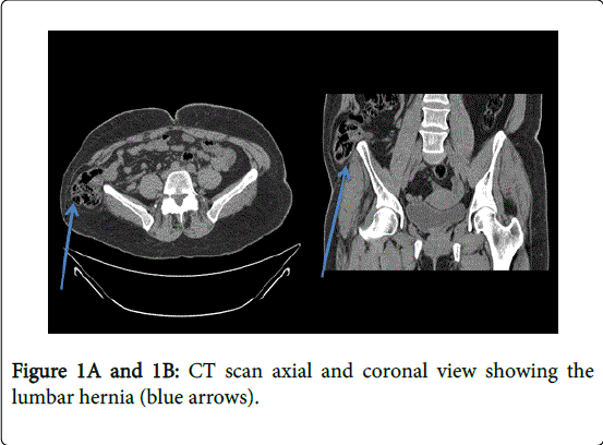 gastrointestinal-digestive-system-blue-arrows