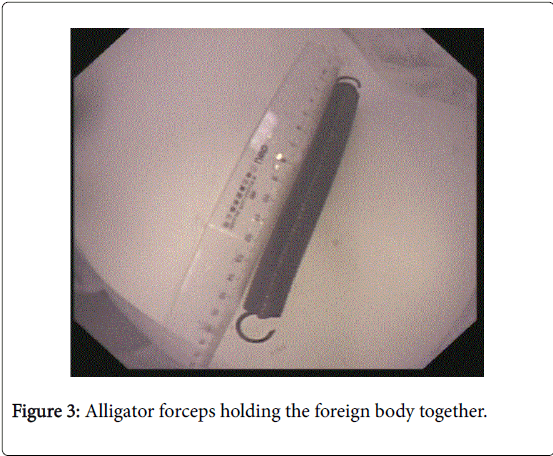 gastrointestinal-digestive-system-body-together
