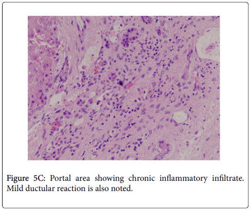 gastrointestinal-digestive-system-chronic-inflammatory