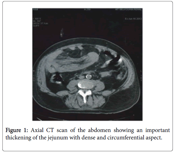 gastrointestinal-digestive-system-circumferential-aspect