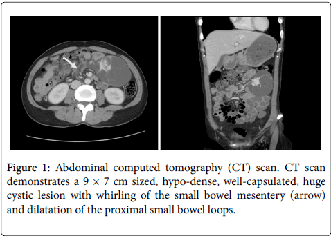 gastrointestinal-digestive-system-computed-tomography