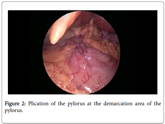 gastrointestinal-digestive-system-demarcation-area