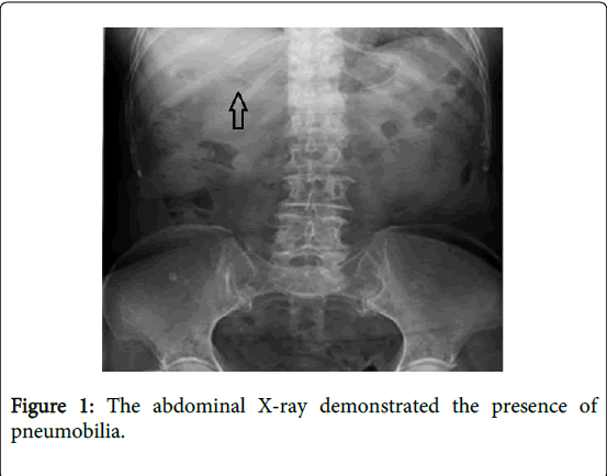 gastrointestinal-digestive-system-demonstrated-presence