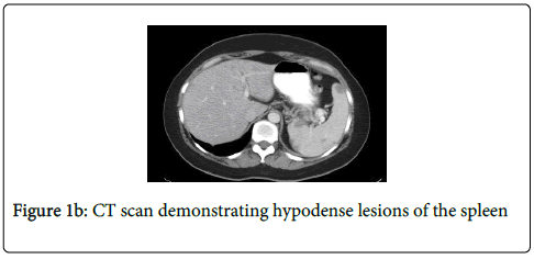 gastrointestinal-digestive-system-demonstrating-hypodense