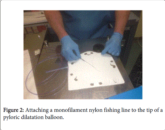 gastrointestinal-digestive-system-dilatation-balloon