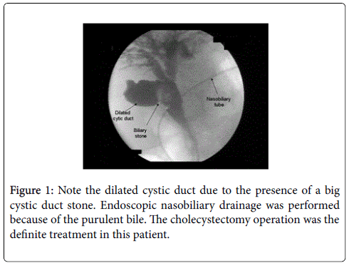 gastrointestinal-digestive-system-dilated-cystic