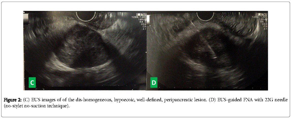 gastrointestinal-digestive-system-dis-homogeneous