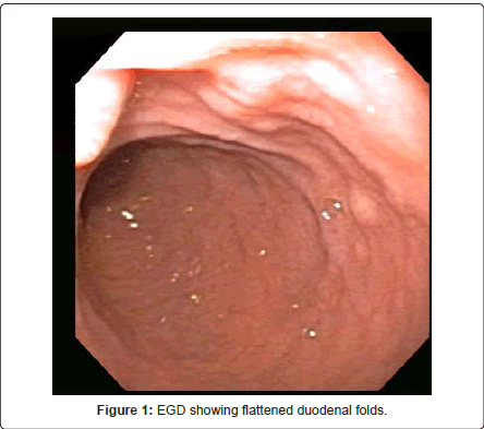 gastrointestinal-digestive-system-duodenal-folds