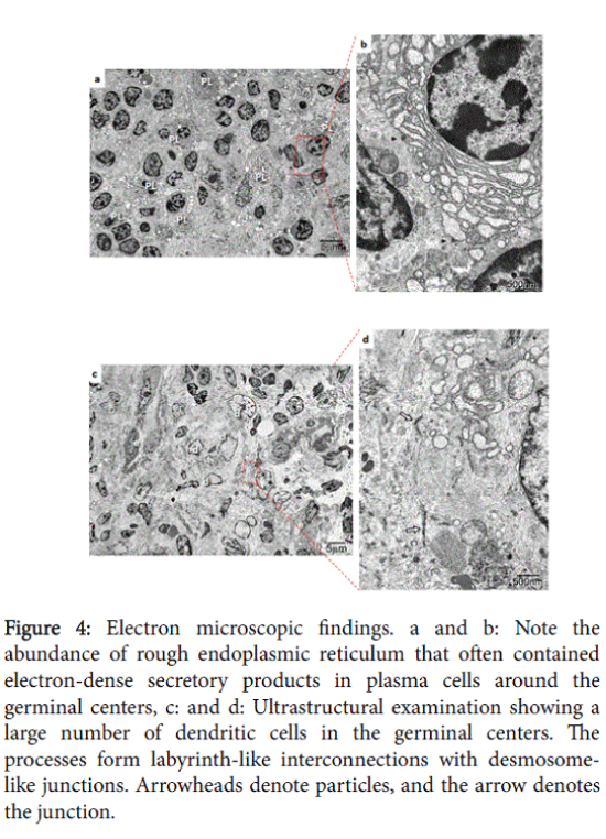gastrointestinal-digestive-system-endoplasmic-reticulum