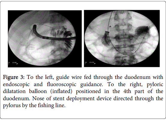 gastrointestinal-digestive-system-fishing-line