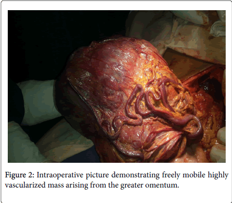 gastrointestinal-digestive-system-freely-mobile