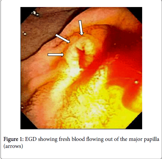 gastrointestinal-digestive-system-fresh-blood