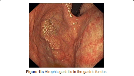 gastrointestinal-digestive-system-gastric-fundus