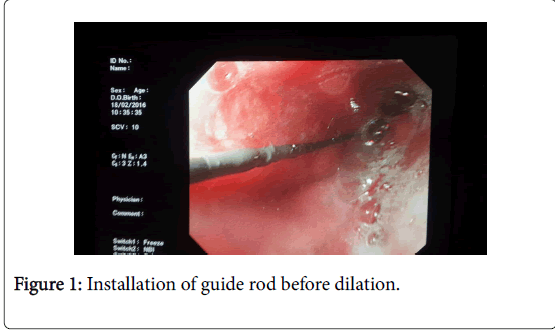 gastrointestinal-digestive-system-guide-rod