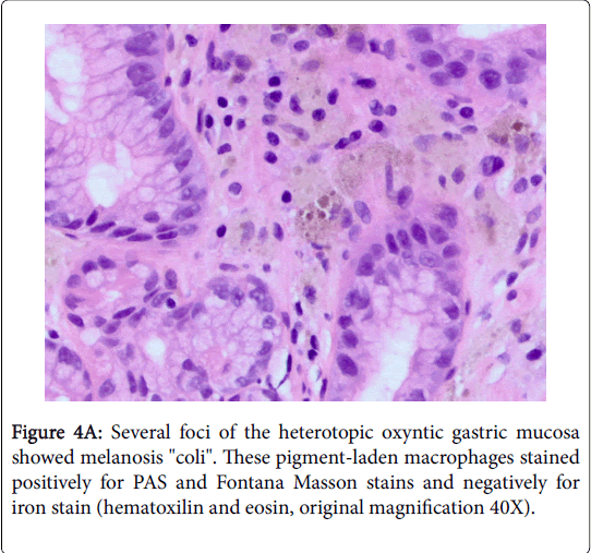 gastrointestinal-digestive-system-heterotopic