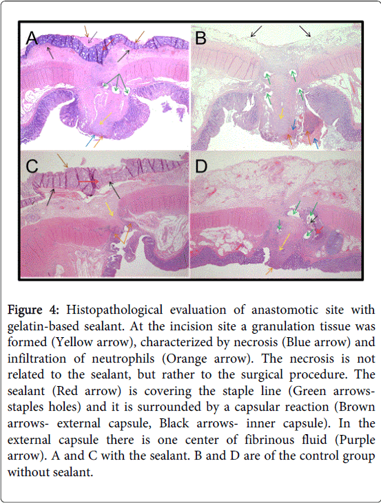 gastrointestinal-digestive-system-incision-site